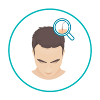 icon-avaliação-capilar